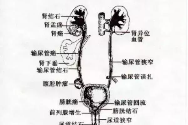 尿血尿频是怎么回事女性（女人为什么反复尿频尿痛尿血）.