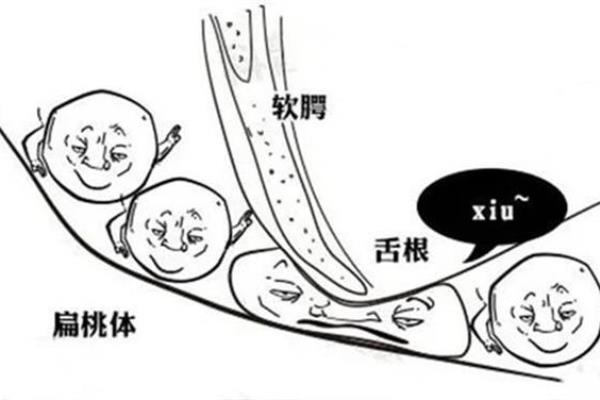 睡眠呼吸暂停引起高血压的原因.